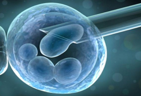 In Embryo Research We Need Laws First, Then Science